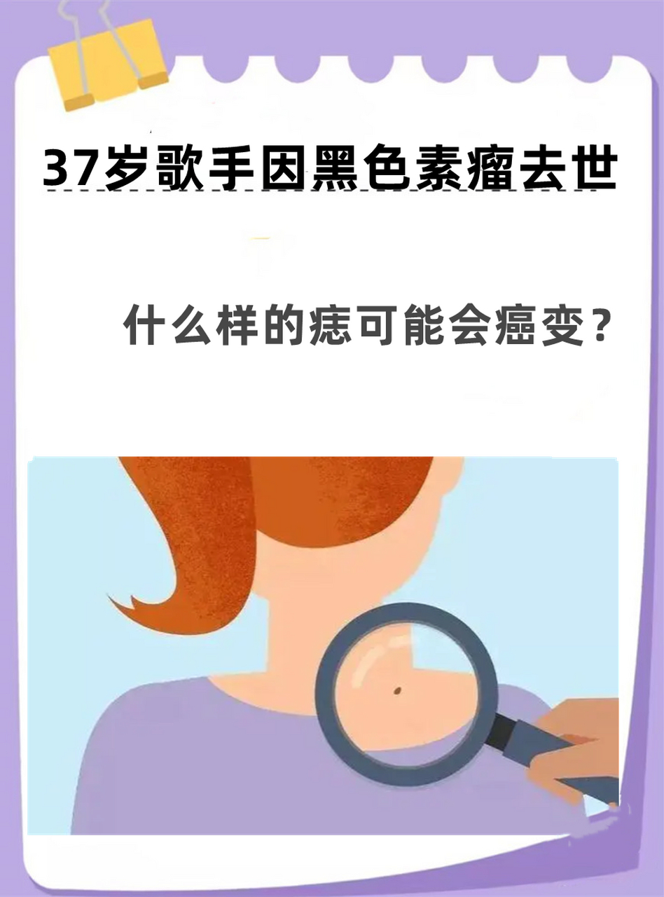 37岁歌手因黑色素瘤去世,什么样的痣可能会癌变?