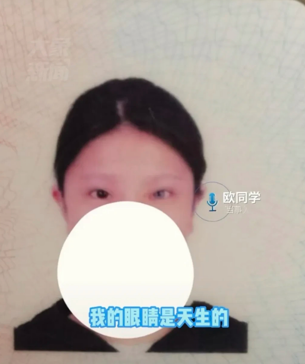 湖南长沙,一位18岁女孩,天生一只蓝眼睛,被认为是戴一只美瞳,总要不停