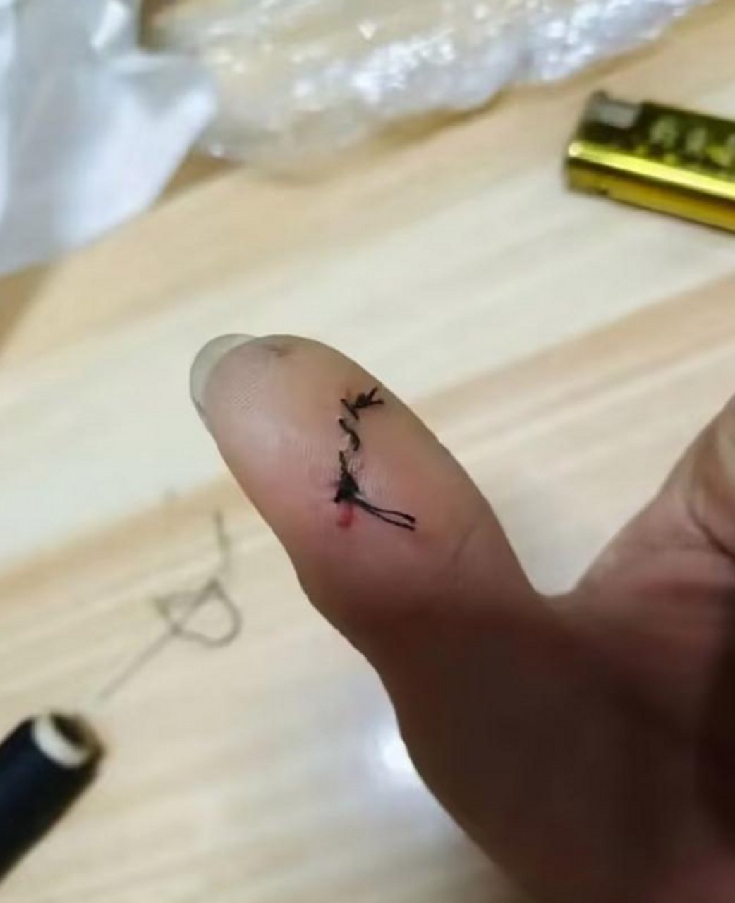 大家觉得我给自己手指缝针的技术怎么样