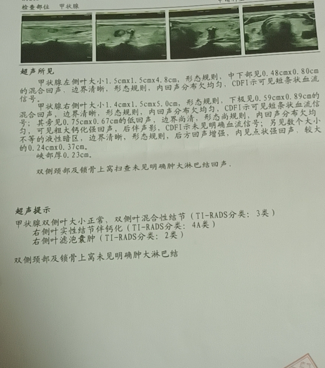 今天和大家聊一下甲状腺结节彩超的问题.