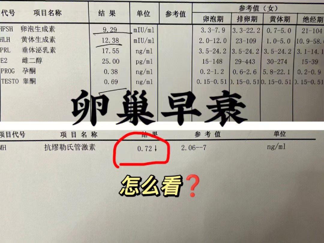 卵巢早衰amh是多少_卵巢早衰amh006多久后会绝经