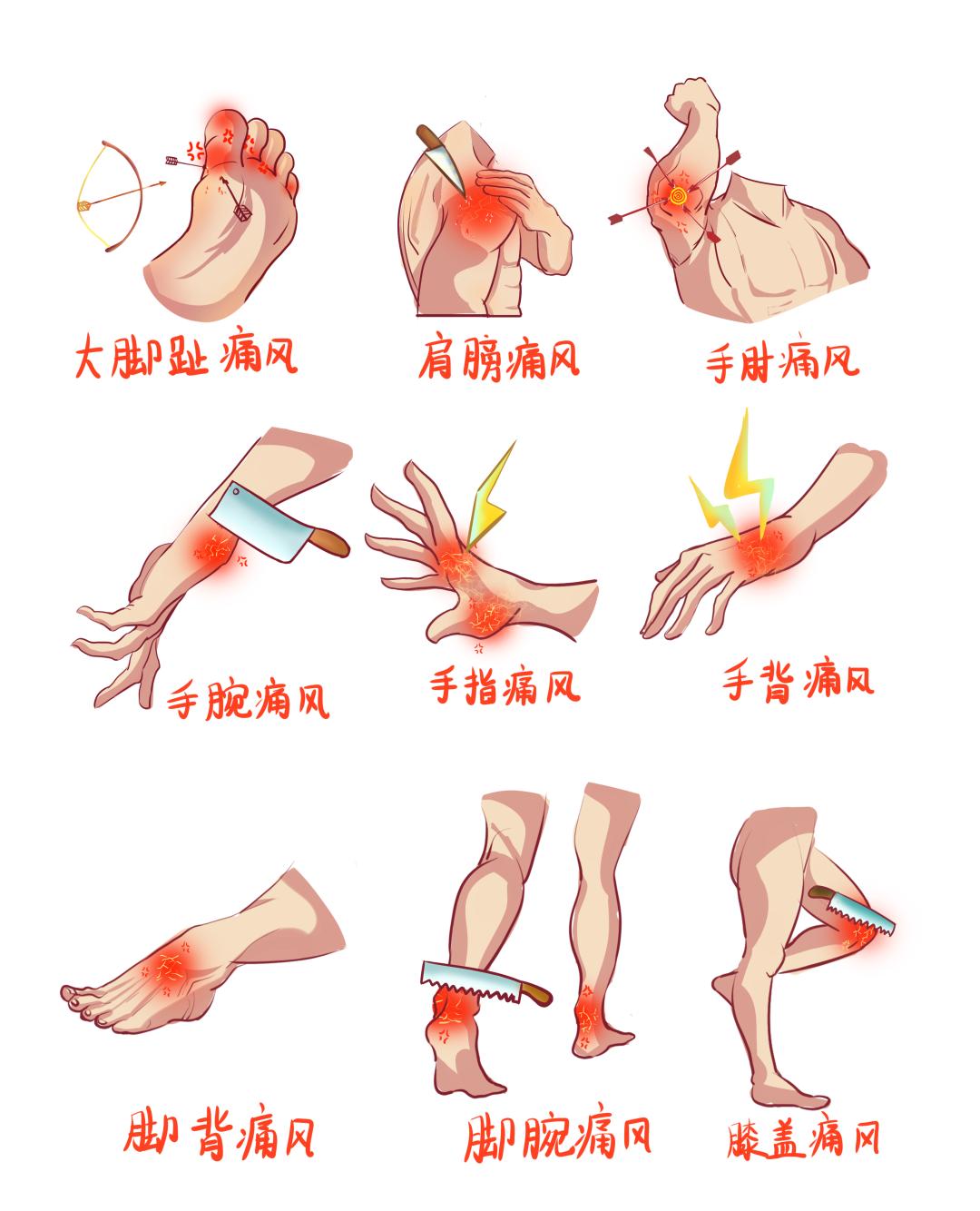 痛风的七个征兆发作图片