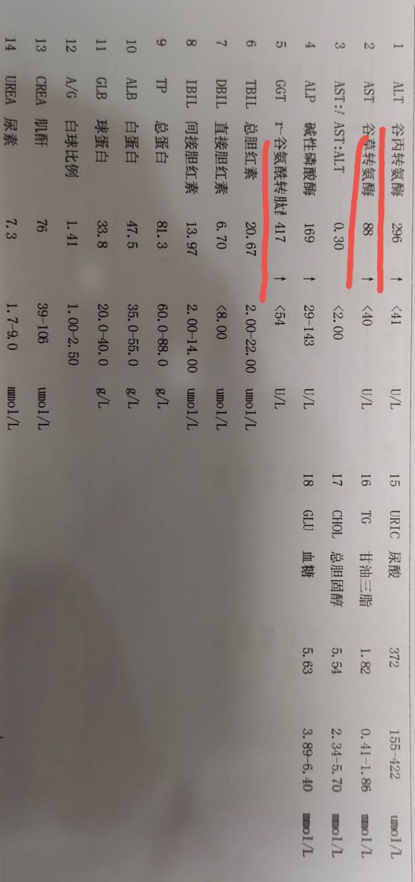 肝功五项化验单怎么看图片