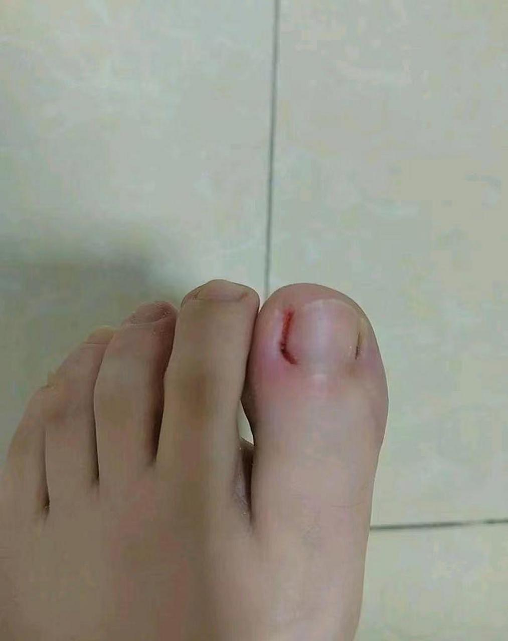 下班走路不小心脚磕到大石头,痛的我想打男朋友,都怪他不来接我.