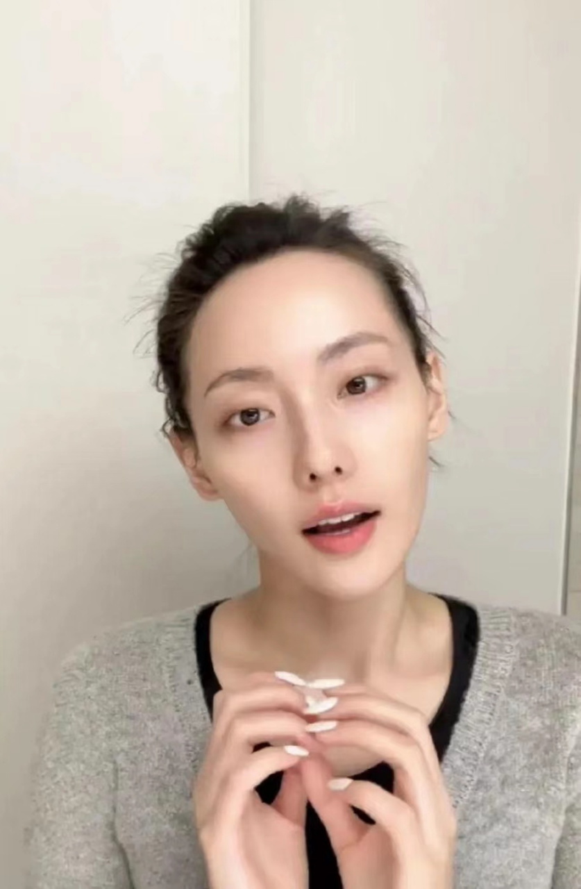 张嘉倪的眼睛好像有点对眼,怪不得她眼神不好