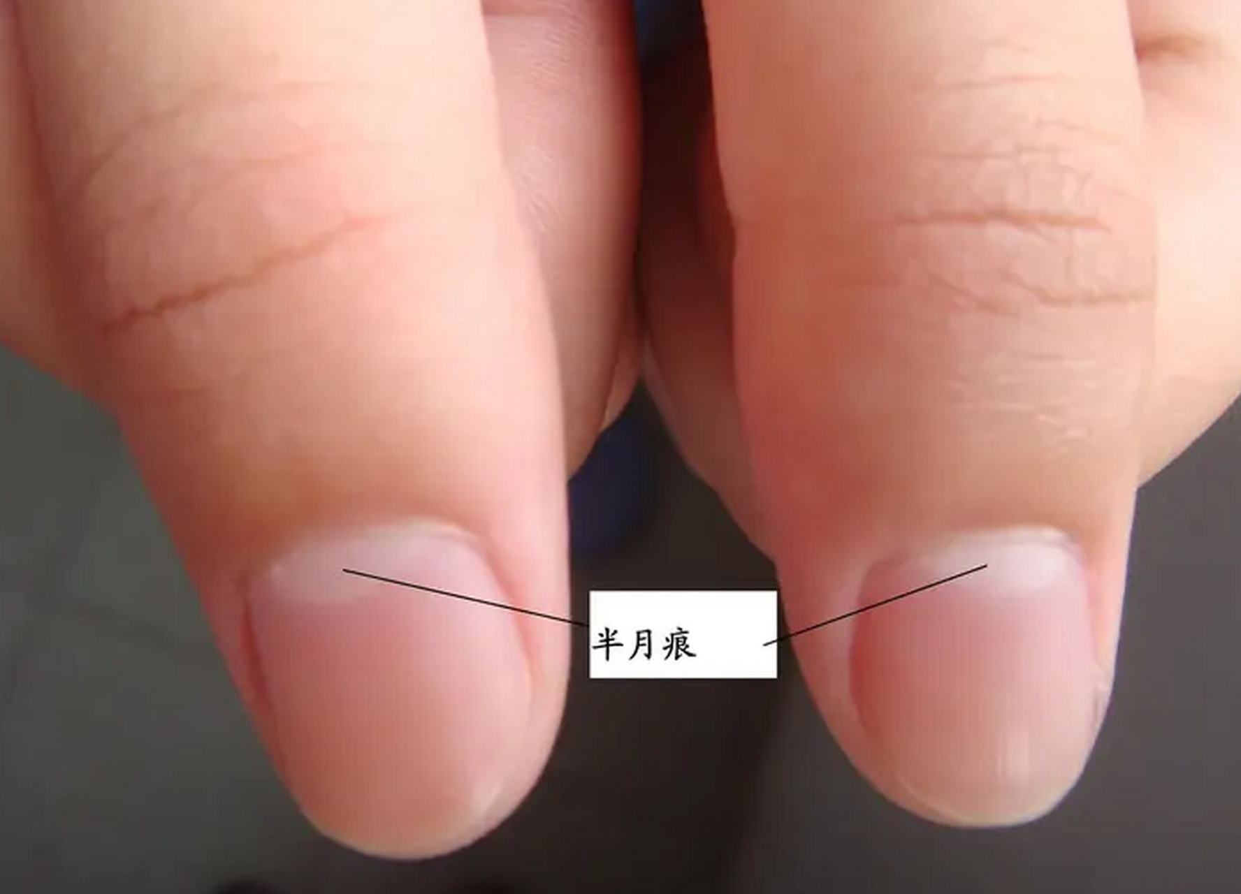 手指甲的月牙只是新长的指甲# 手指上那圈白色月牙是什么?
