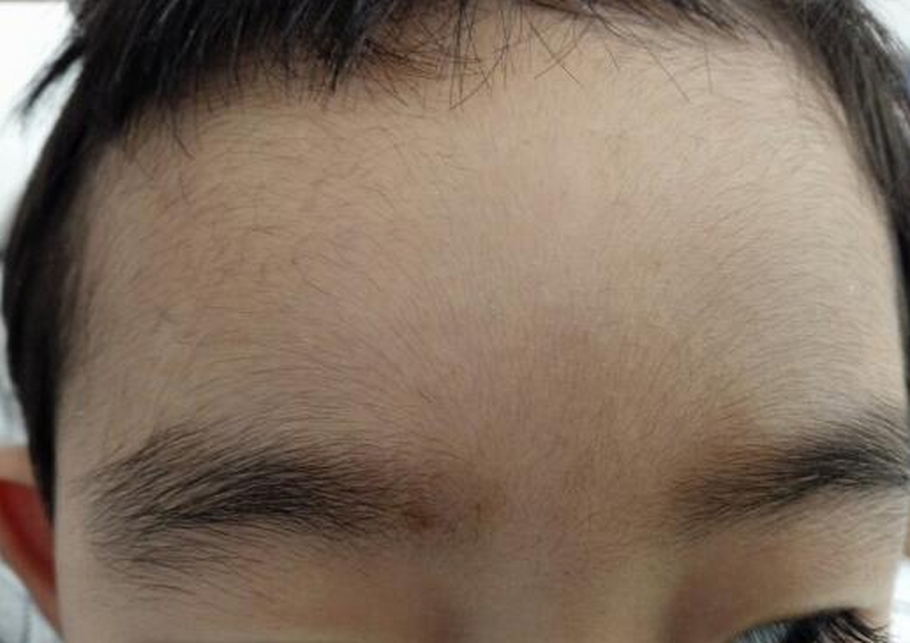 为什么脸上会长毛 为什么脸上会长毛