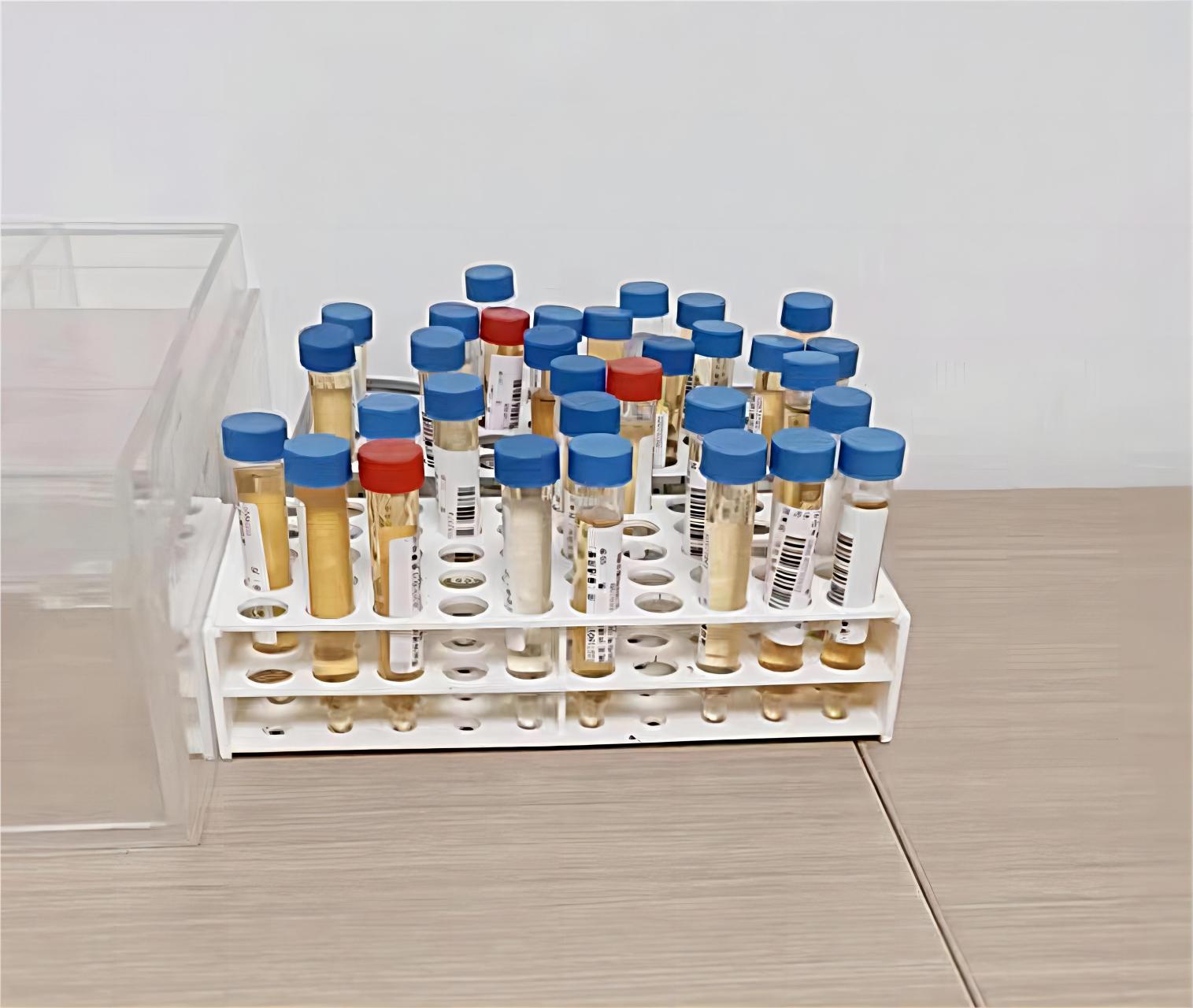 今天去医院体检做尿检,发现每个人的尿液标本颜色都不一样,有些像