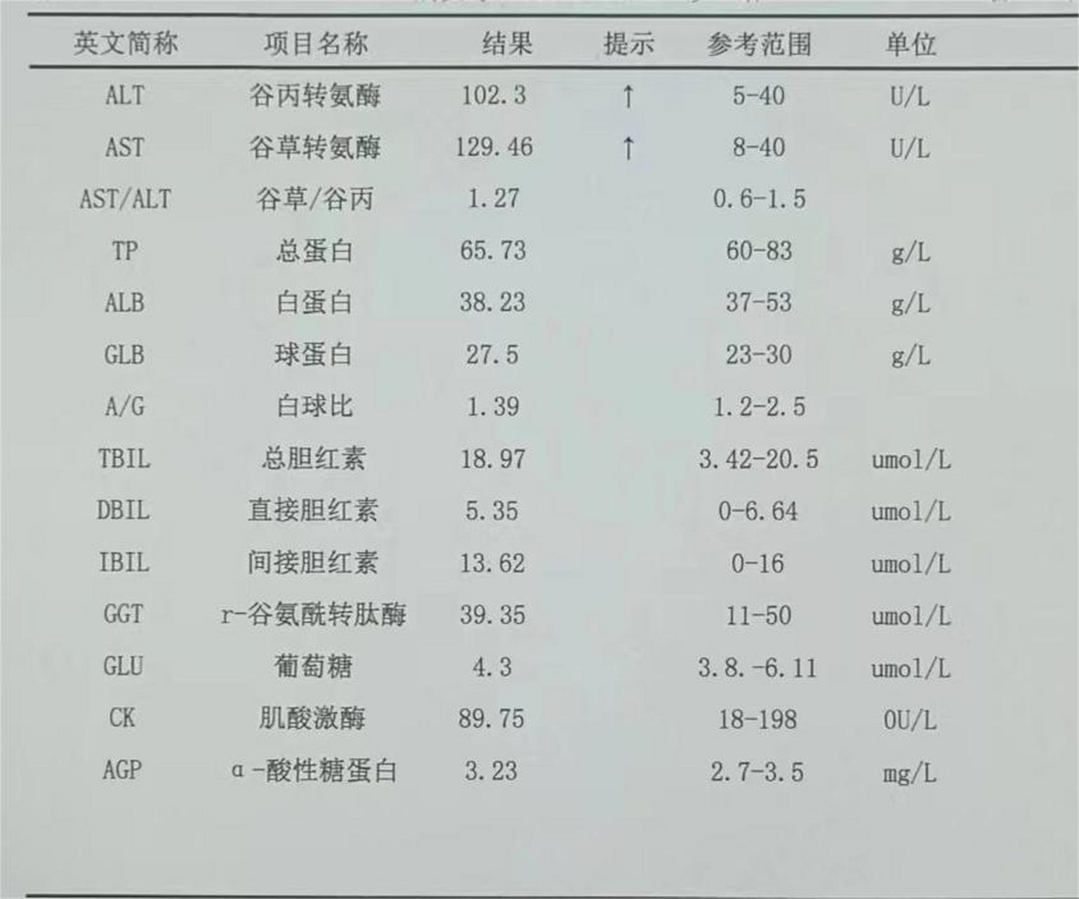 转氨酶正常值图片