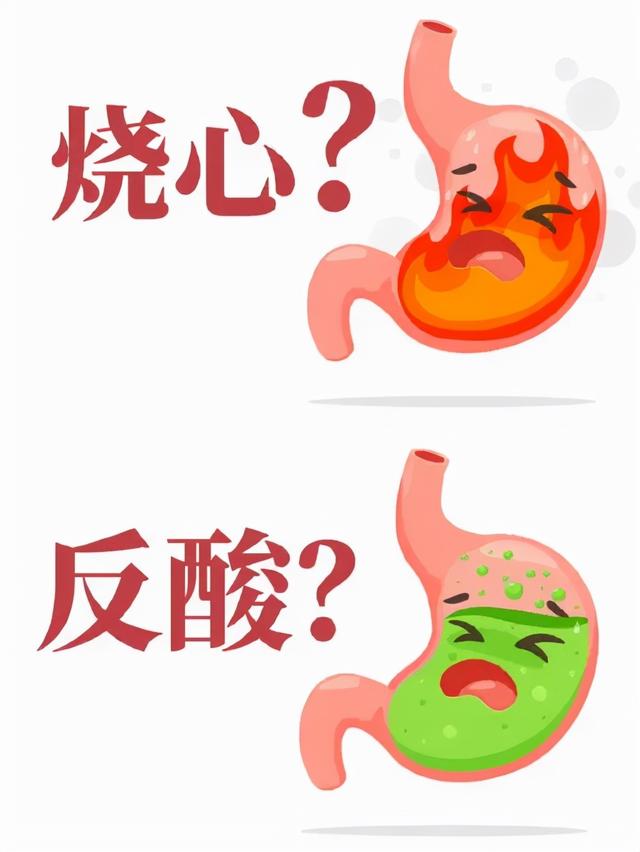 反流性胃炎看起来很正常,但千万别觉得是小病!