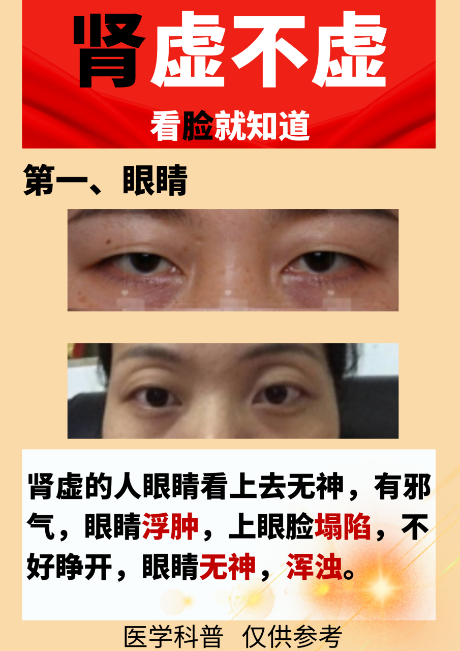 中医# #肾虚# #男性# #男性健康