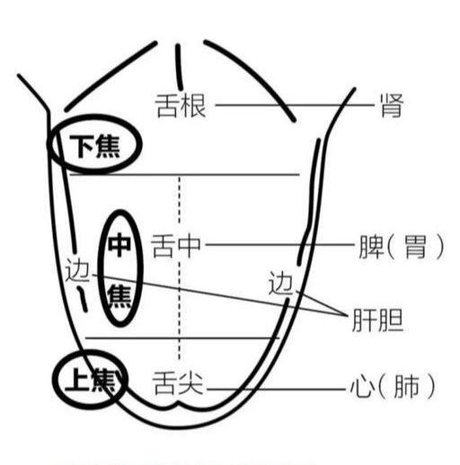 舌根剥落图片