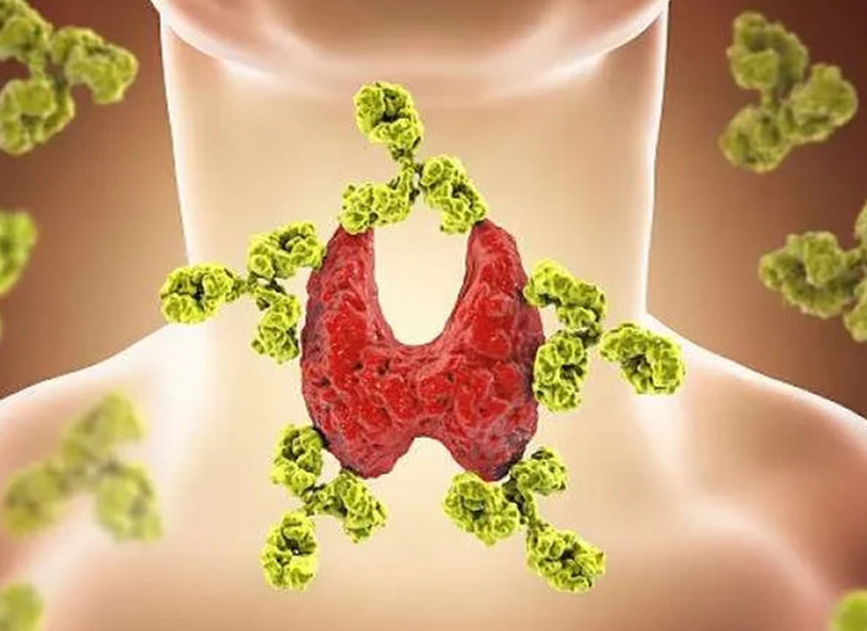 陈长怀# 主任接诊过一位盲目乐观的#甲状腺癌# 患者.