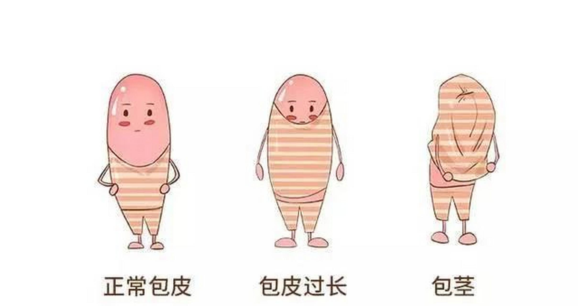 "我的6岁孩子去割包皮了,刚刚才从医院回来."邻居对我说.他儿子近一段