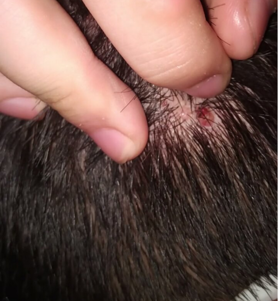 有些人头皮上会长红色的小疙瘩,硬硬的,一触碰到还特别疼.