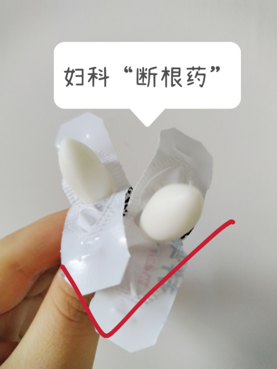 上海医师自留的5个妇科"断根药"  · 【1】yd炎——双唑泰栓 成分