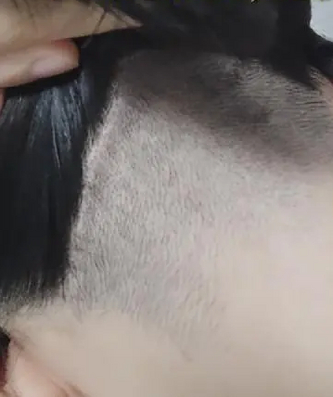 女子后脑勺头发被理发师剃掉一半#  8月8日,在贵州贵阳,女生称后脑 