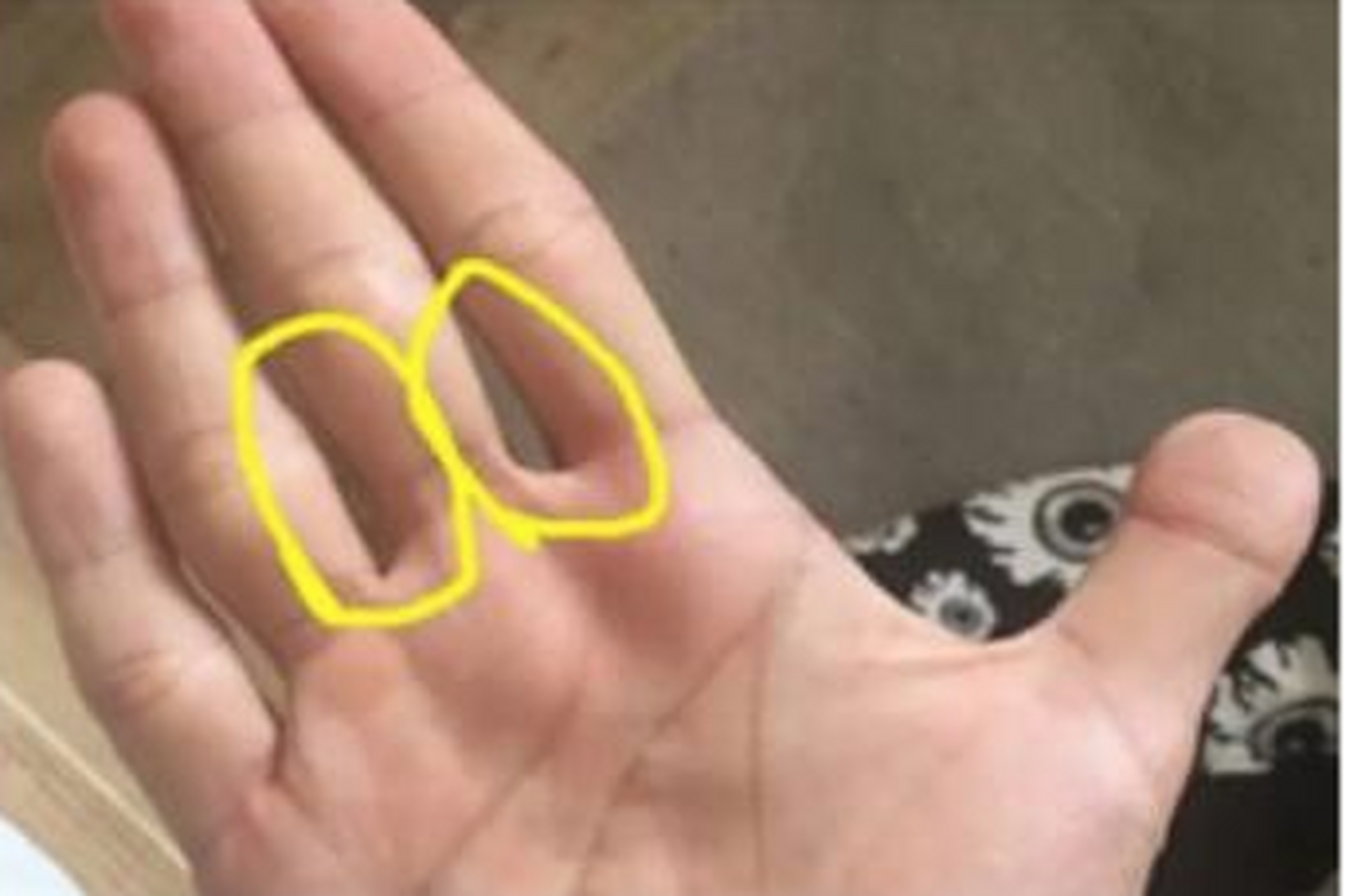 肝脏好不好,看看中指根!