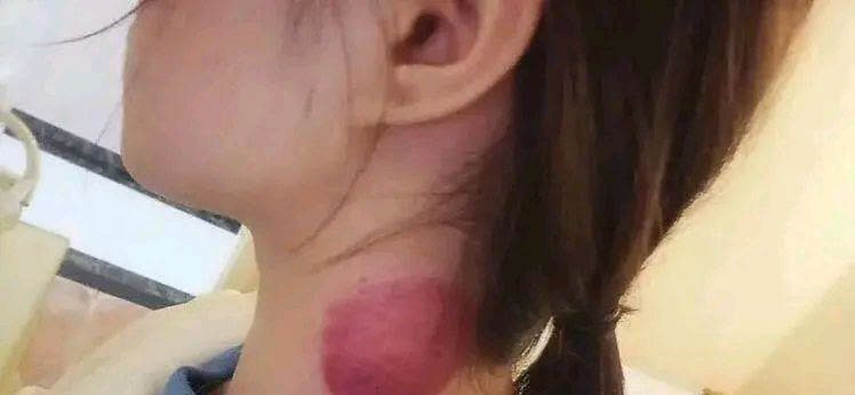 网友:我有点困惑,女孩脖子上有胎记,我应该继续和她在一起吗?[坏笑]