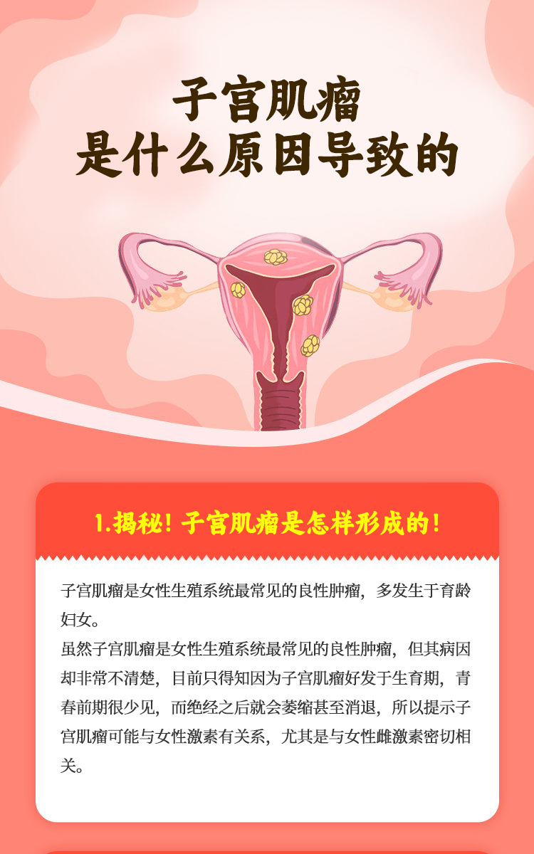 [小红花]虽然子宫肌瘤是女性生殖系统最常见的良性肿瘤,但其病因却