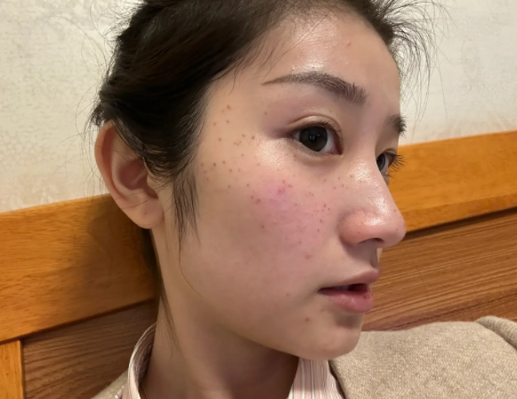 通过长期的护理和实践,我积累了一些淡化颧骨两侧斑点的禁言,现在分享