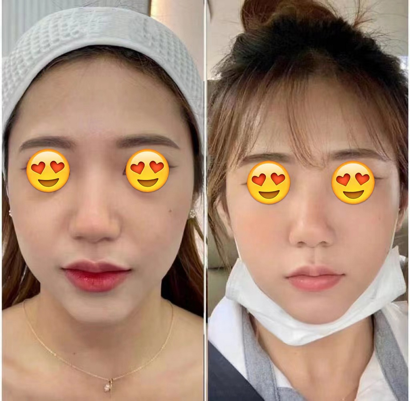 郑州30岁妹子,和老公自驾到成都做轮廓固定,顺便旅行一圈.