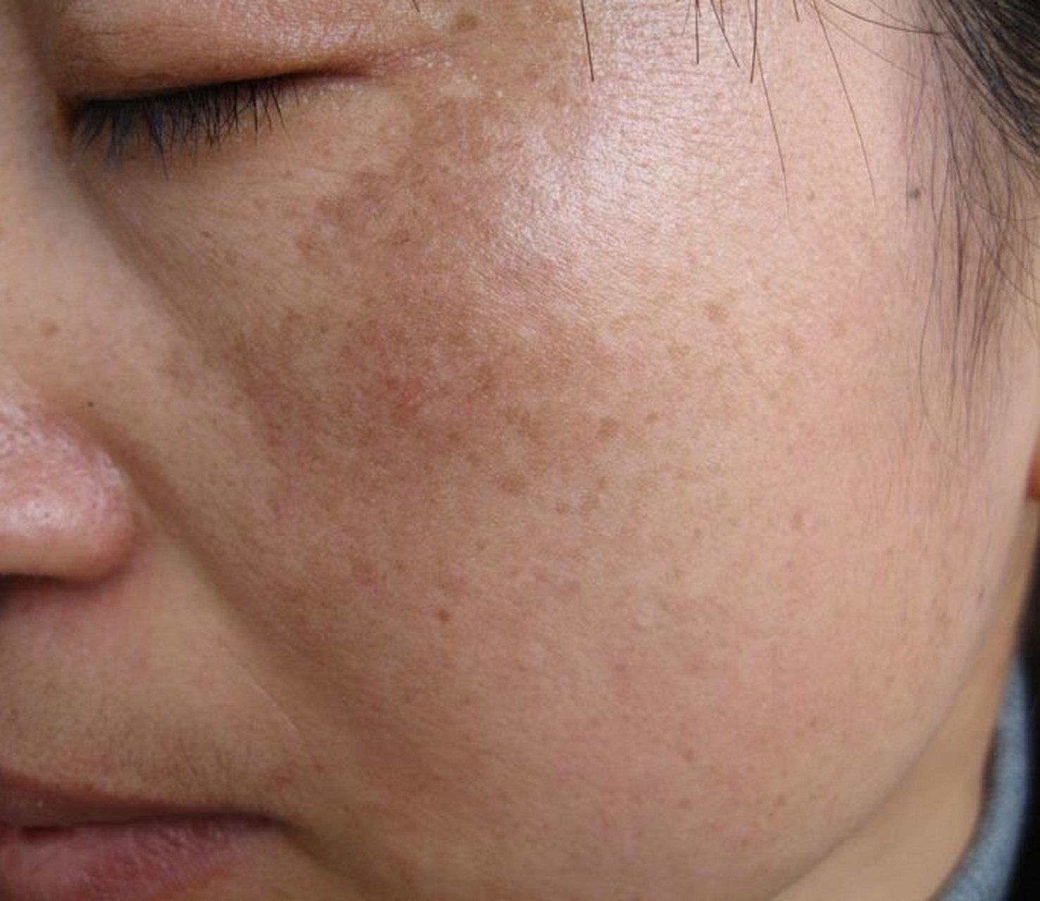 用好两味药,滋肝养肾,赶走黄褐斑,大家好,我是北