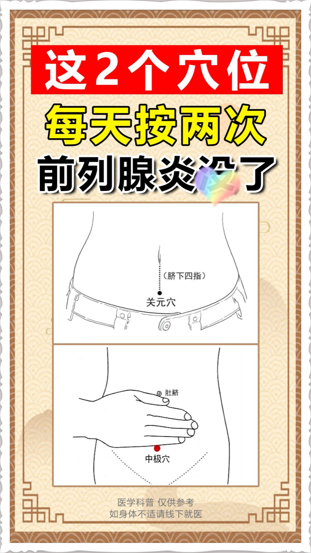 这2个穴位,每天按两下,前列腺炎很快改善 1,关元穴;  2,中极穴.