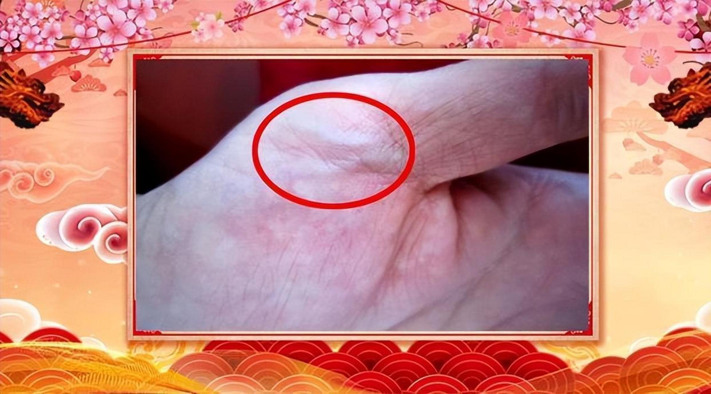 手上青筋多,多注意心脏和血管!