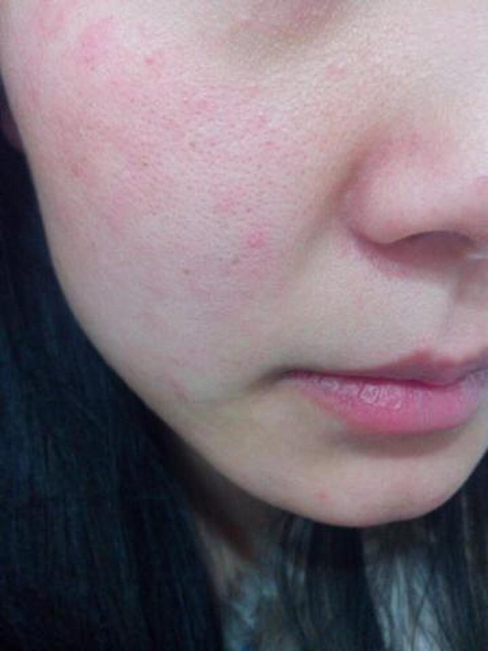 一,了解脸部角质层  脸部角质层是指皮肤最上层的