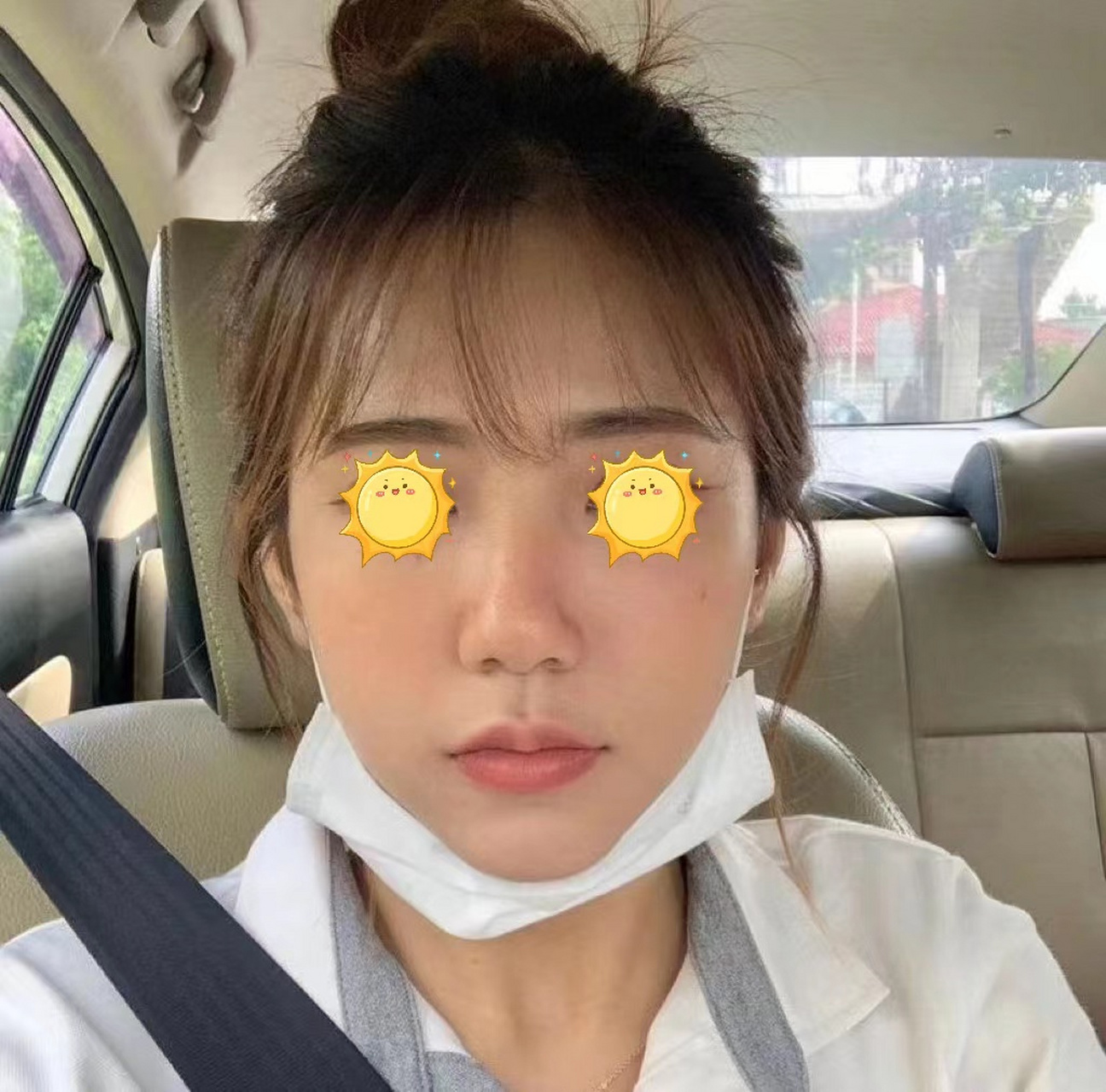 郑州30岁妹子,和老公自驾到成都做轮廓固定,顺便旅行一圈.