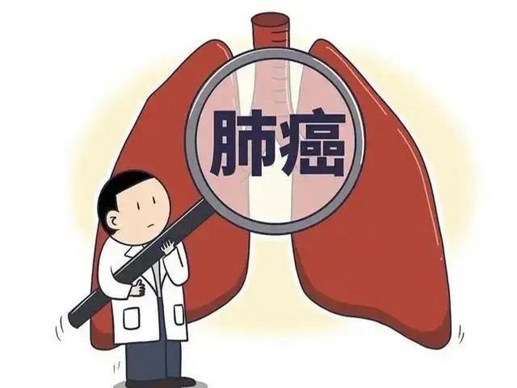 早期肺癌可以射频消融吗?