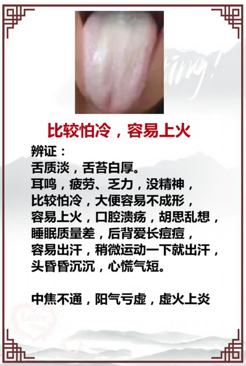 【上热下寒常见的舌象:身体越寒,越容易上火】 粉丝主诉:比较怕冷