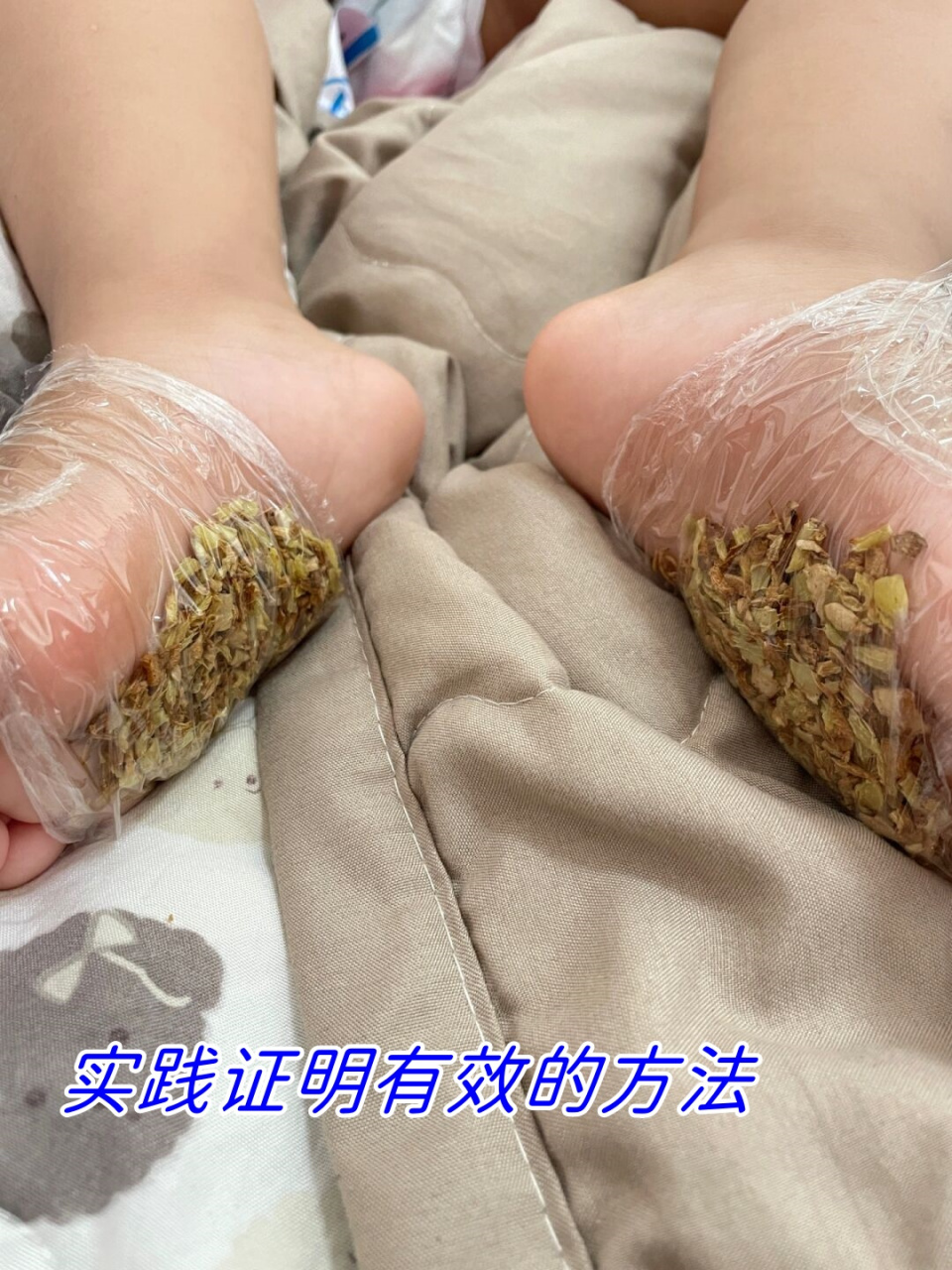 生姜放脚底退烧法图片