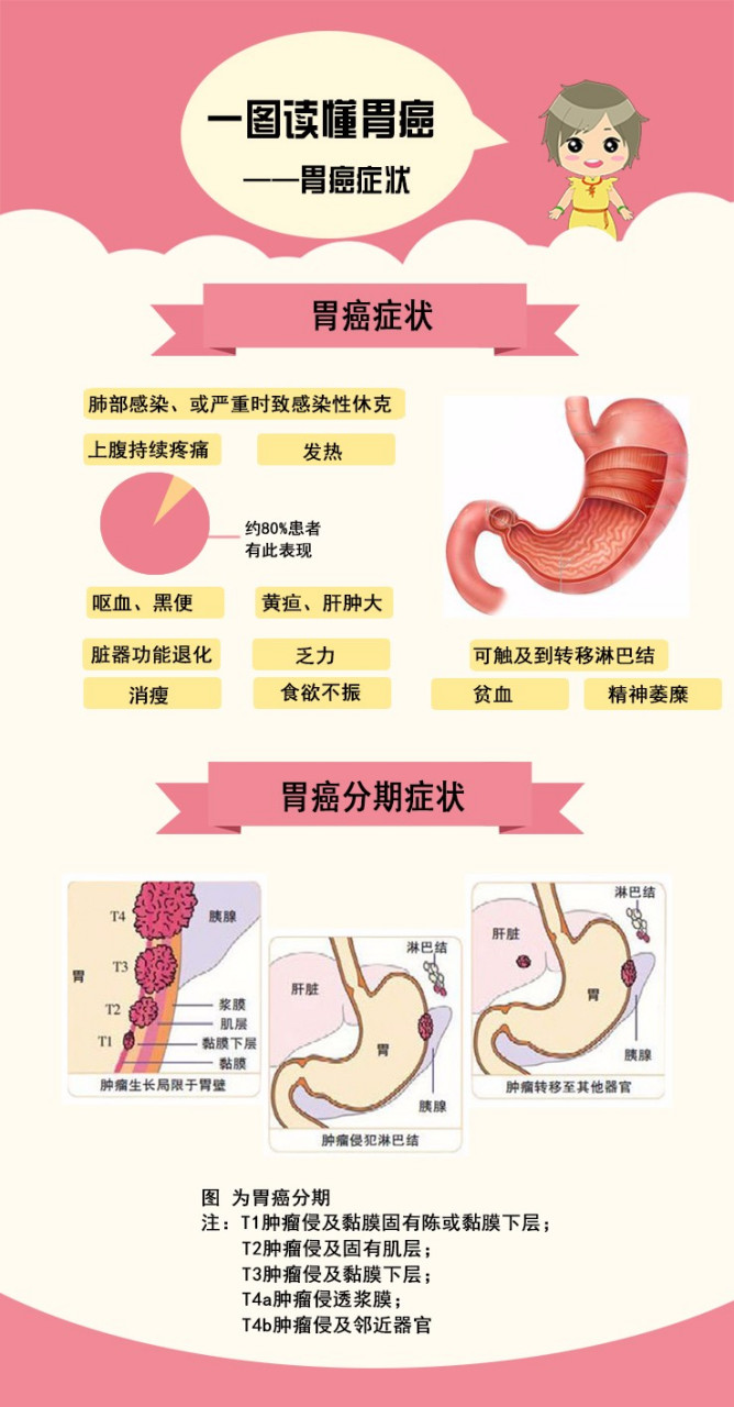 胃癌的症状和前兆图片