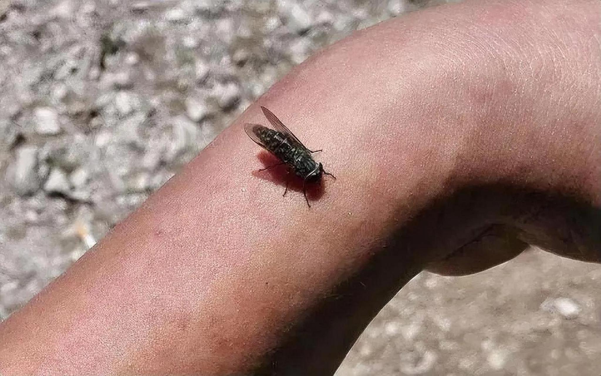 在农村池塘河湖里游泳后常常会遭遇牛虻的叮咬