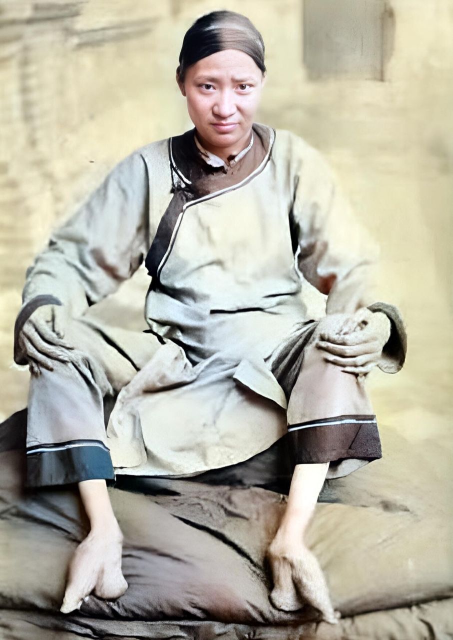 清末时期,四川一位裹足女子,在镜头前非常大胆的展示自己的"三寸金莲"