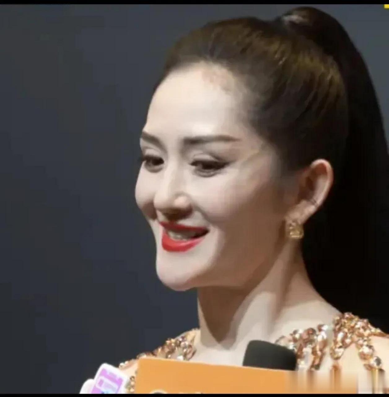 谢娜这脸整的,完全就是鞋拔子脸,下巴太尖了,好像明星整容,最后下巴都