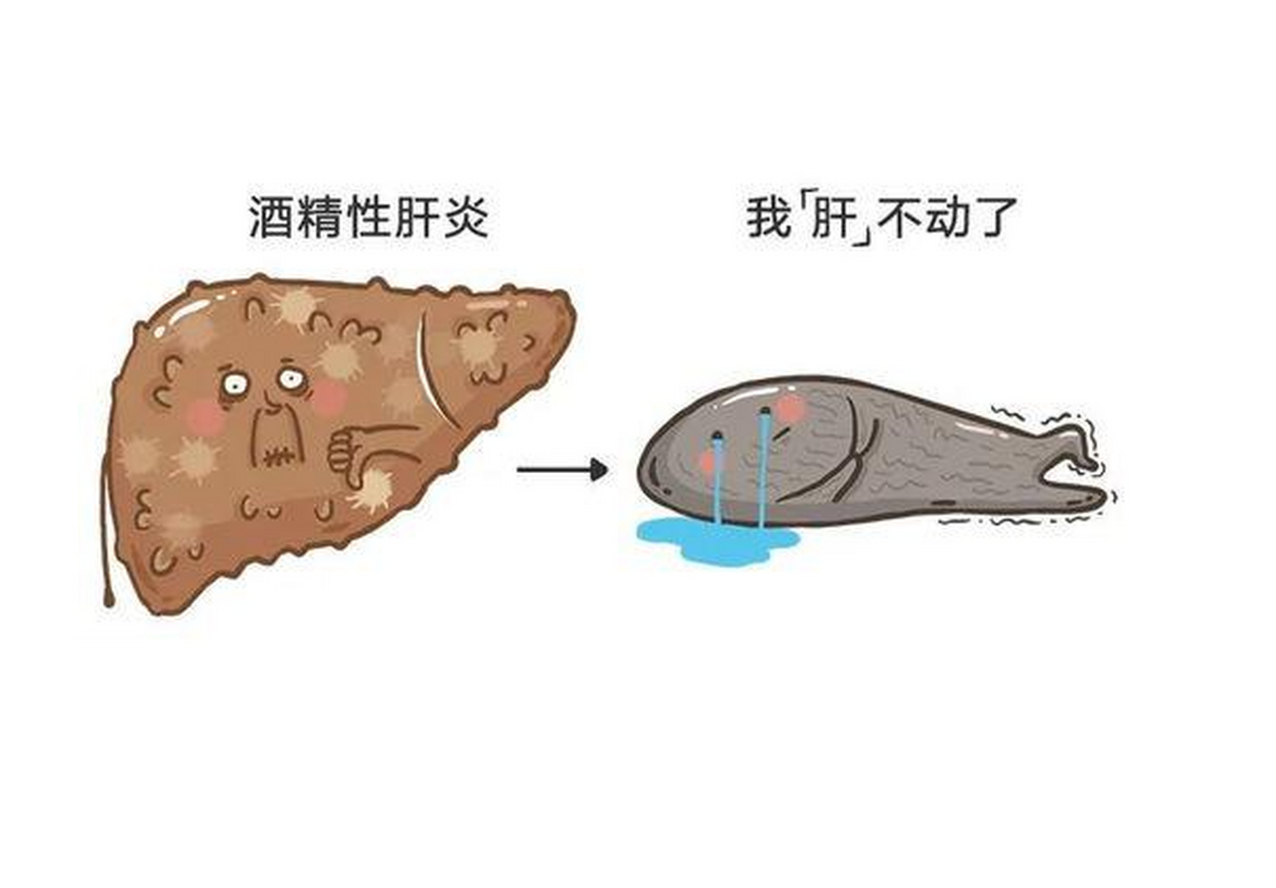 1, 轻症酒精性肝病:肝脏生物化学指标,影像学和组织病理学检查基本