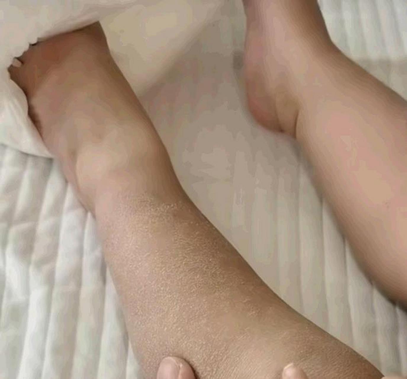 孩子有没有长期不洗澡或者皮肤是这样的[大笑]