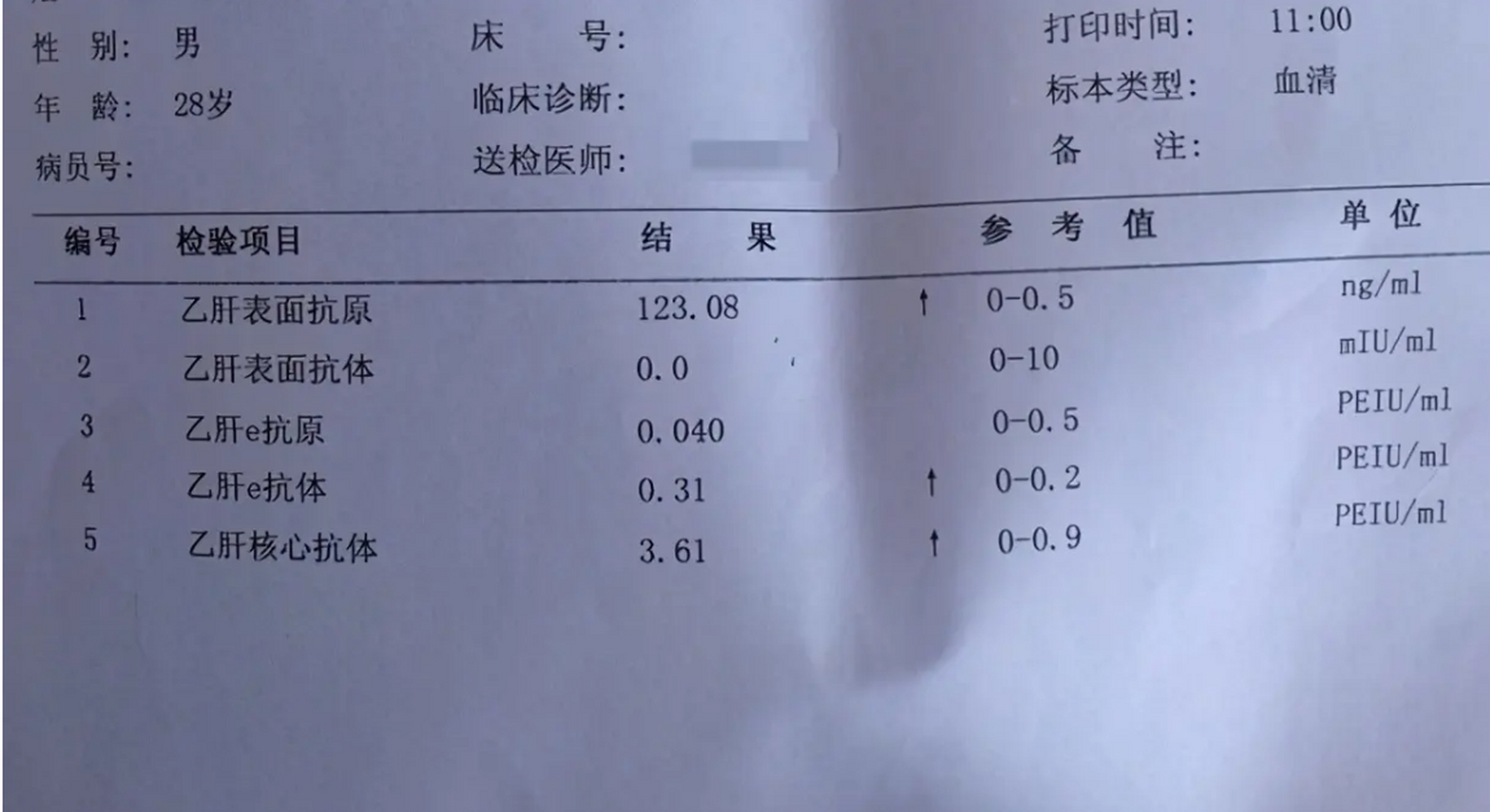 乙肝两对半怎么看结果图片