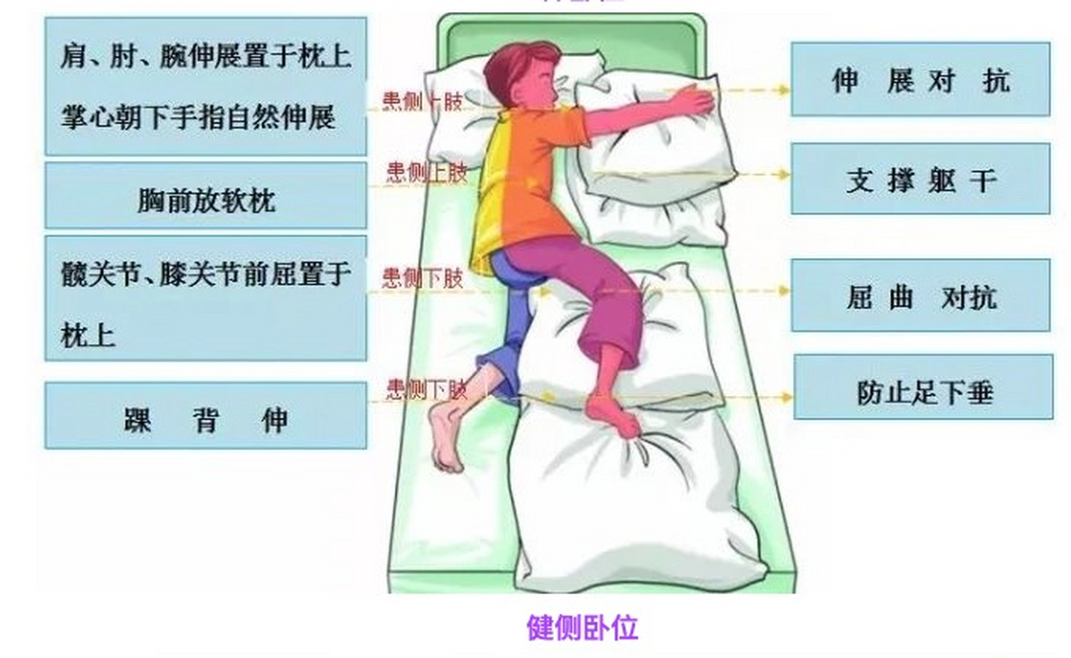 偏瘫患者良肢位摆放ppt图片