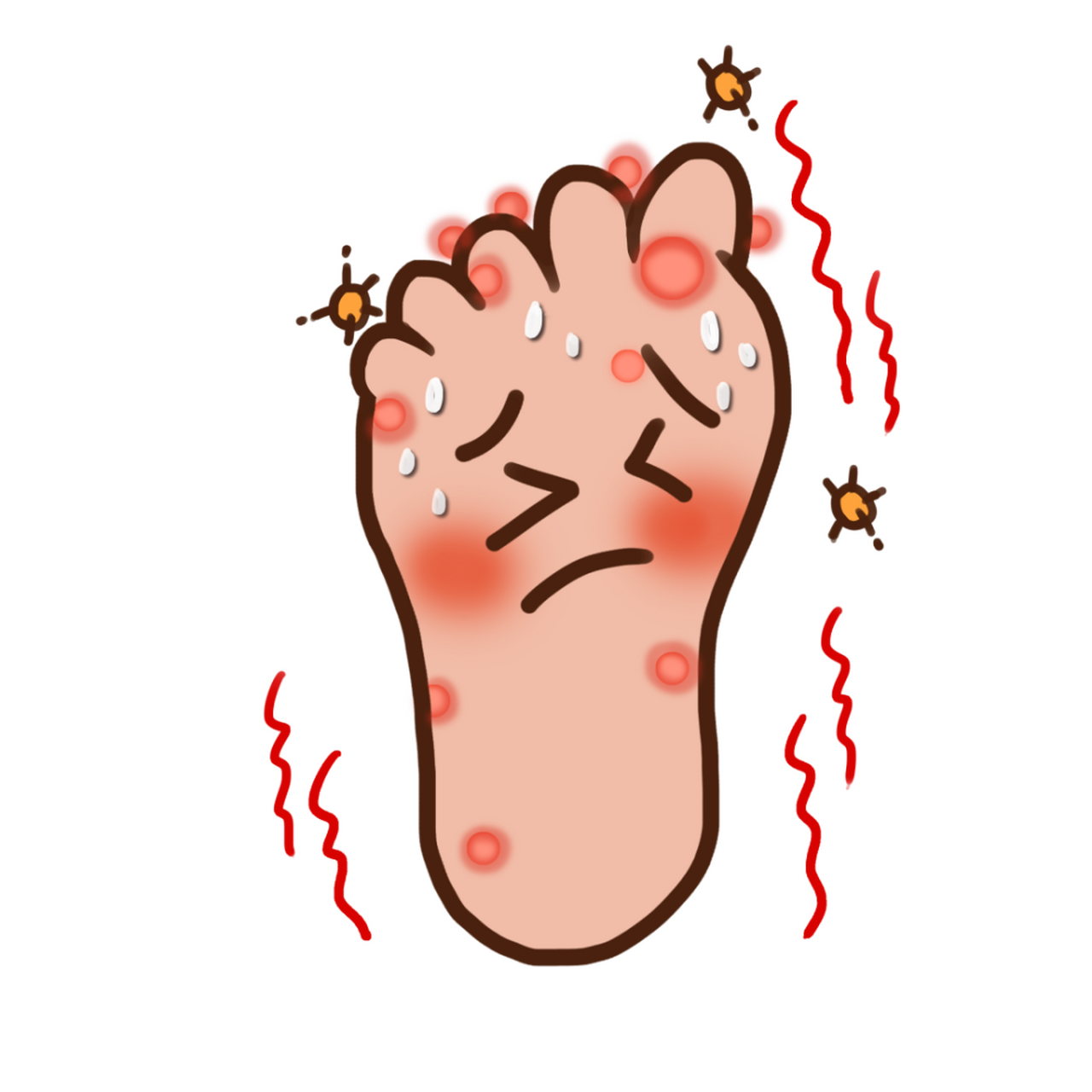 足癣临床表现和分型#足癣# #手足脚癣# #南京看手足癣哪家医院好#  1