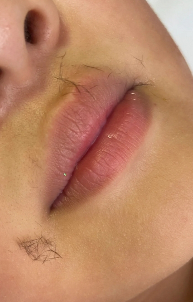 唇毛是女性常见的困扰之一,对于很多女生来说,想要拥有光滑细嫩的嘴唇