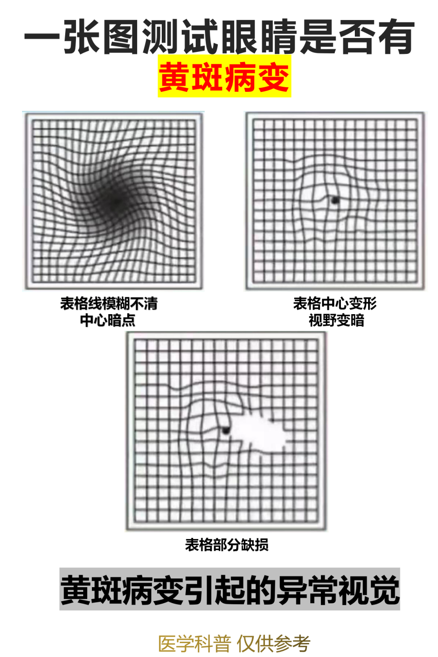 黄斑图测试图片