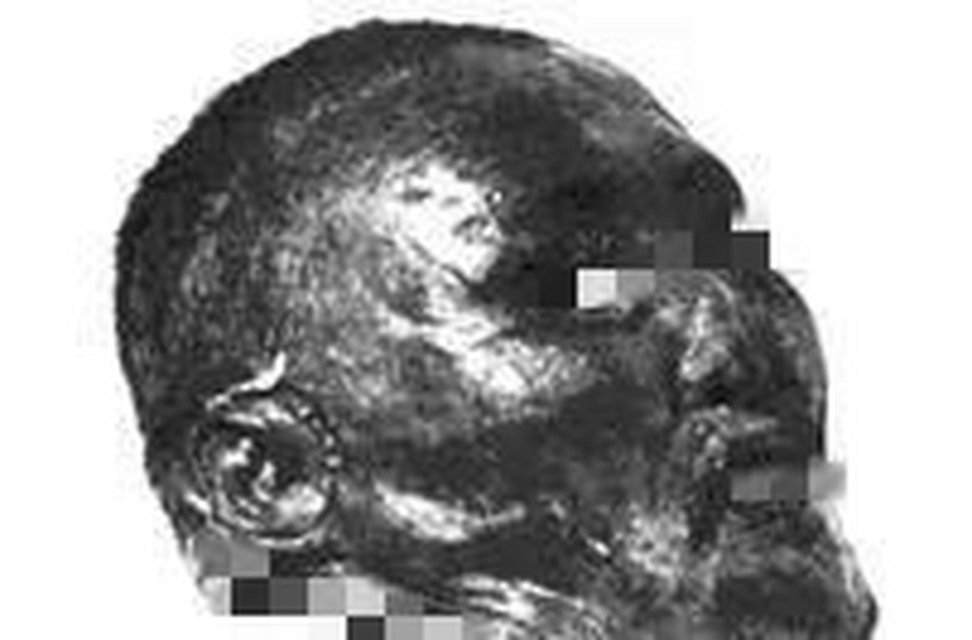 1924年,一颗面容狰狞的头颅被浸泡在福尔马林溶液中,这个头颅的主人就