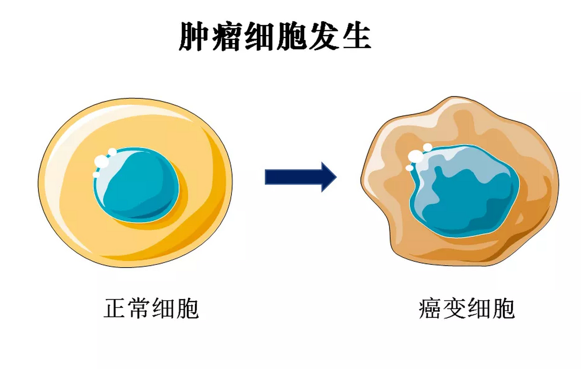 【肿瘤是怎么产生的 两张图告诉你,肿瘤是怎么产生的.