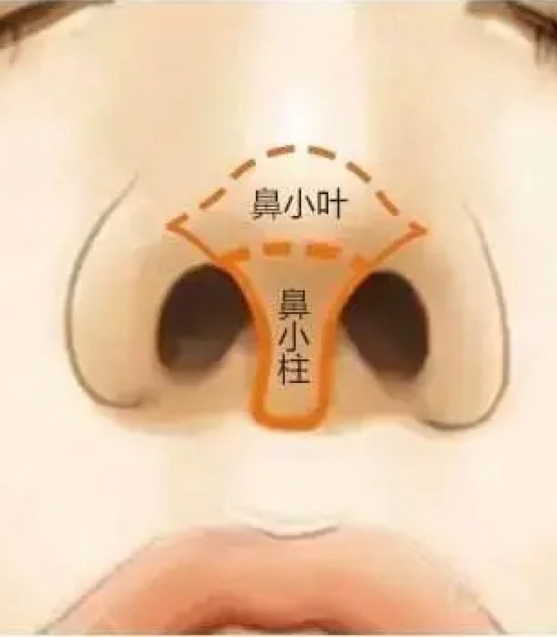 它是指鼻子下部与面颊交界处的区域,通常是指鼻翼两侧靠近鼻孔的区域.