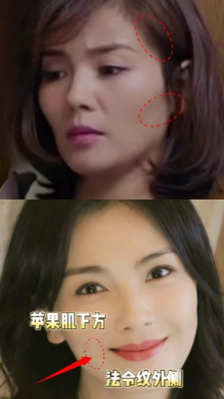 刘涛是怎么做到一夜回春,逆龄生长的?