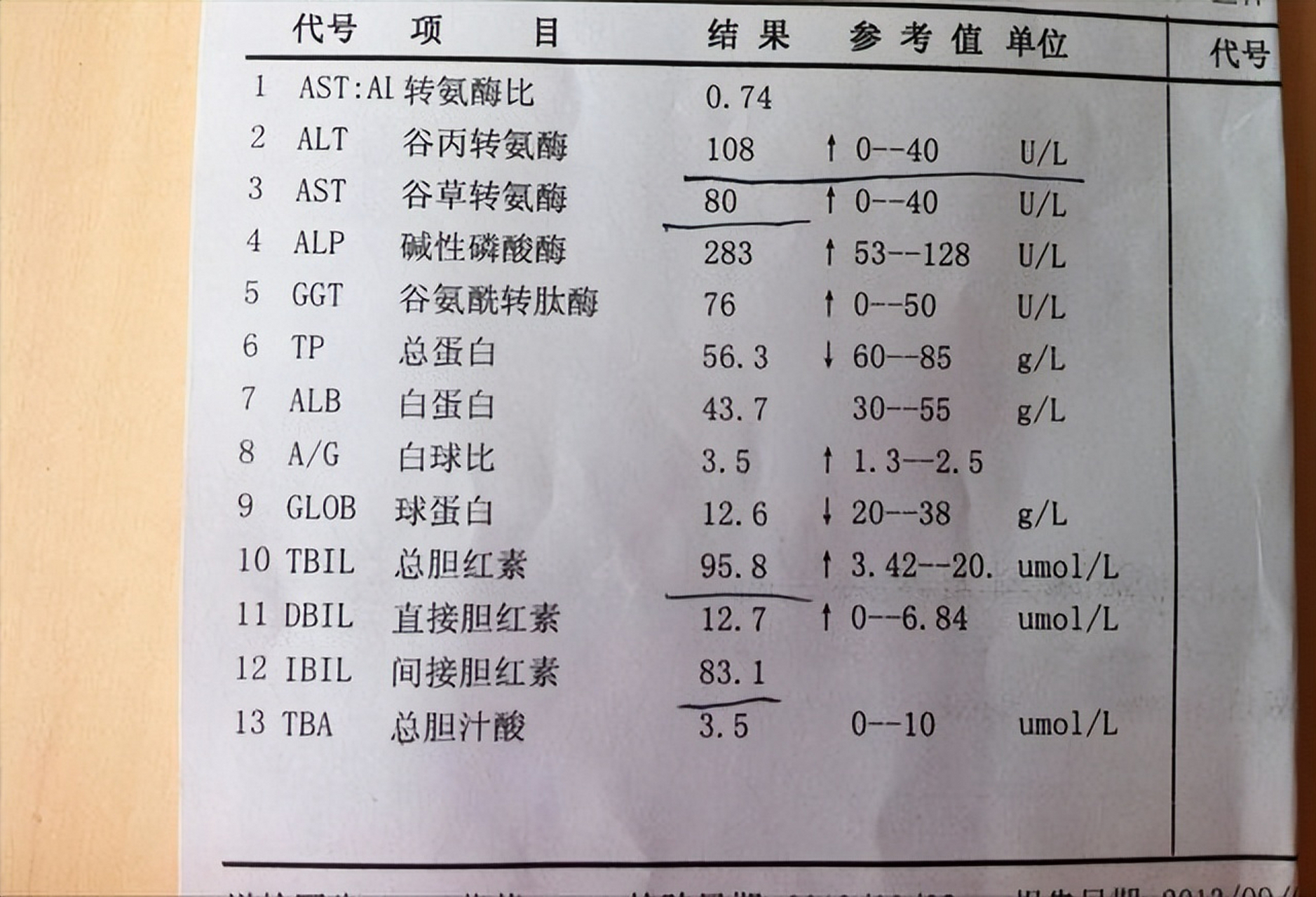 转氨酶检查图片